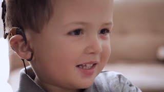 Cochlear Implant  Mateos Story